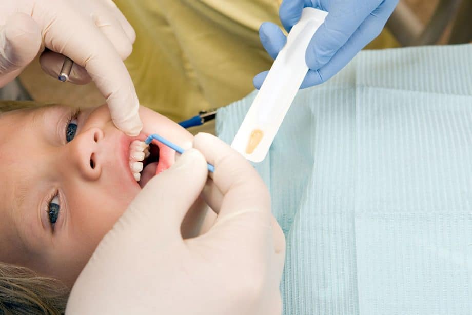 Child getting fluoride